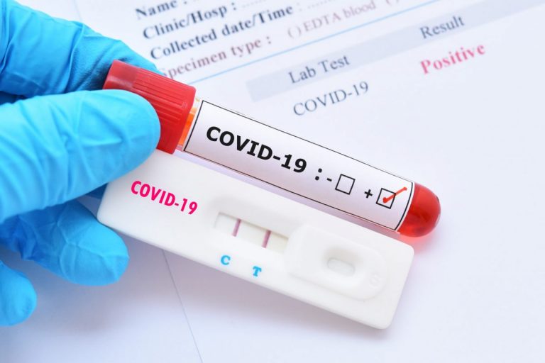 Franţa autorizează vânzarea de teste anti-COVID-19 în marile magazine
