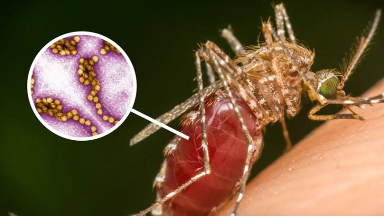 Un nou caz de infectare cu Virusul West Nile confirmat în R. Moldova