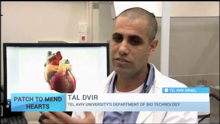 Cercetătorii israelieni au printat în 3D o inimă folosind țesut uman – VIDEO