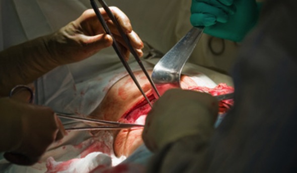 Mai multe transplanturi de organe, făcute în spitalele din Liov fără energie electrică