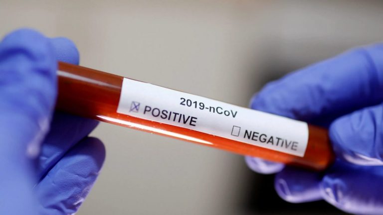 Medic italian, pozitiv pentru COVID-19 la șase zile după ce a fost vaccinat