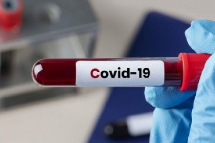 Numărul cazurilor de COVID-19 a crescut cu 30%