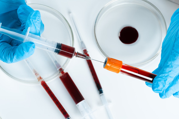 Rezultate încurajatoare pentru un tratament inovator împotriva hemofiliei