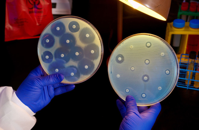 ‘Superbacteriile’ rezistente la antibiotice fac ravagii în SUA! Numărul deceselor a crescut cu 15%