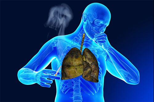 UE autorizează un nou tratament pentru bronşita tabagică