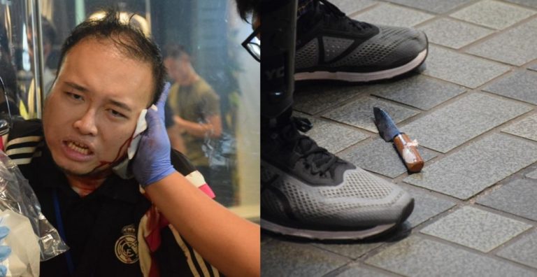 Incident violent în Hong Kong: Un agresor necunoscut i-a smuls o parte din ureche unui politician pro-democrație