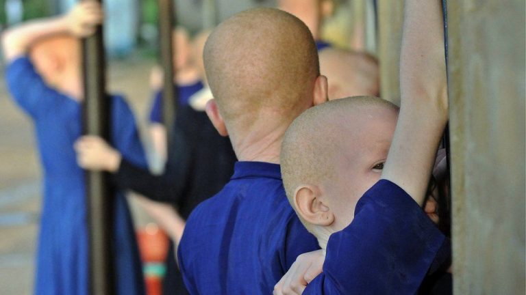 Un val misterios de sechestrări de persoane cu albinism a zguduit Madagascarul