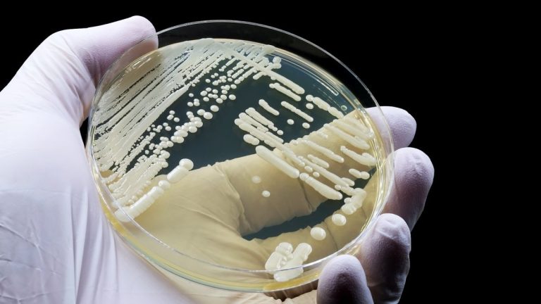 O infecție fungică încă necunoscută a făcut primele victime: Este ‘nemaiîntâlnită la om’