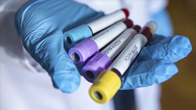 5,5% dintre donatorii de sânge olandezi au anticorpi împotriva coronavirusului