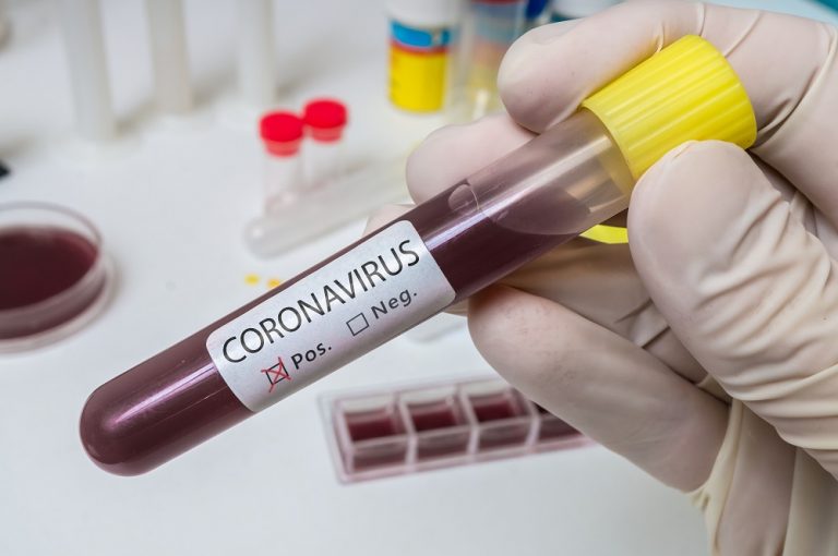 Israelul a depistat o variantă neidentificată a coronavirusului