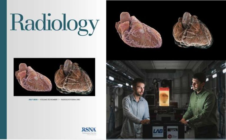 Prima cartografiere 3D a inimii până la scară celulară (ESRF)