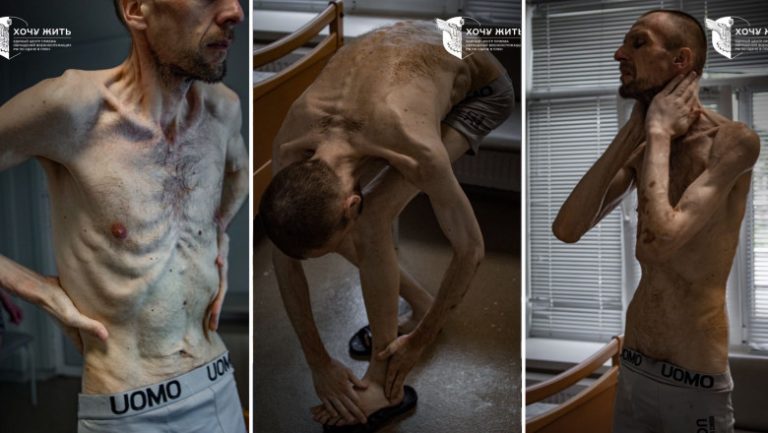 Imagini șocante cu un prizonier ucrainean după doi ani de captivitate în Rusia. „Ca în lagărele de concentrare naziste ale morții”.