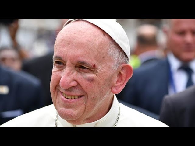 Papa Francisc s-a rănit în ultima etapă a turneului său în Columbia, în timp ce mergea cu papamobilul