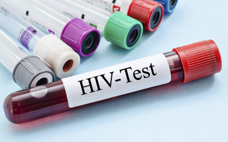 O nouă variantă de HIV mai virulentă a fost identificată în Ţările de Jos